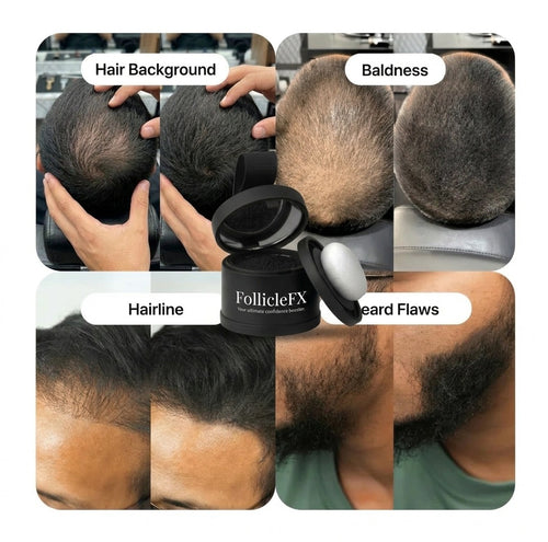 RBS Collective FollicleFX®