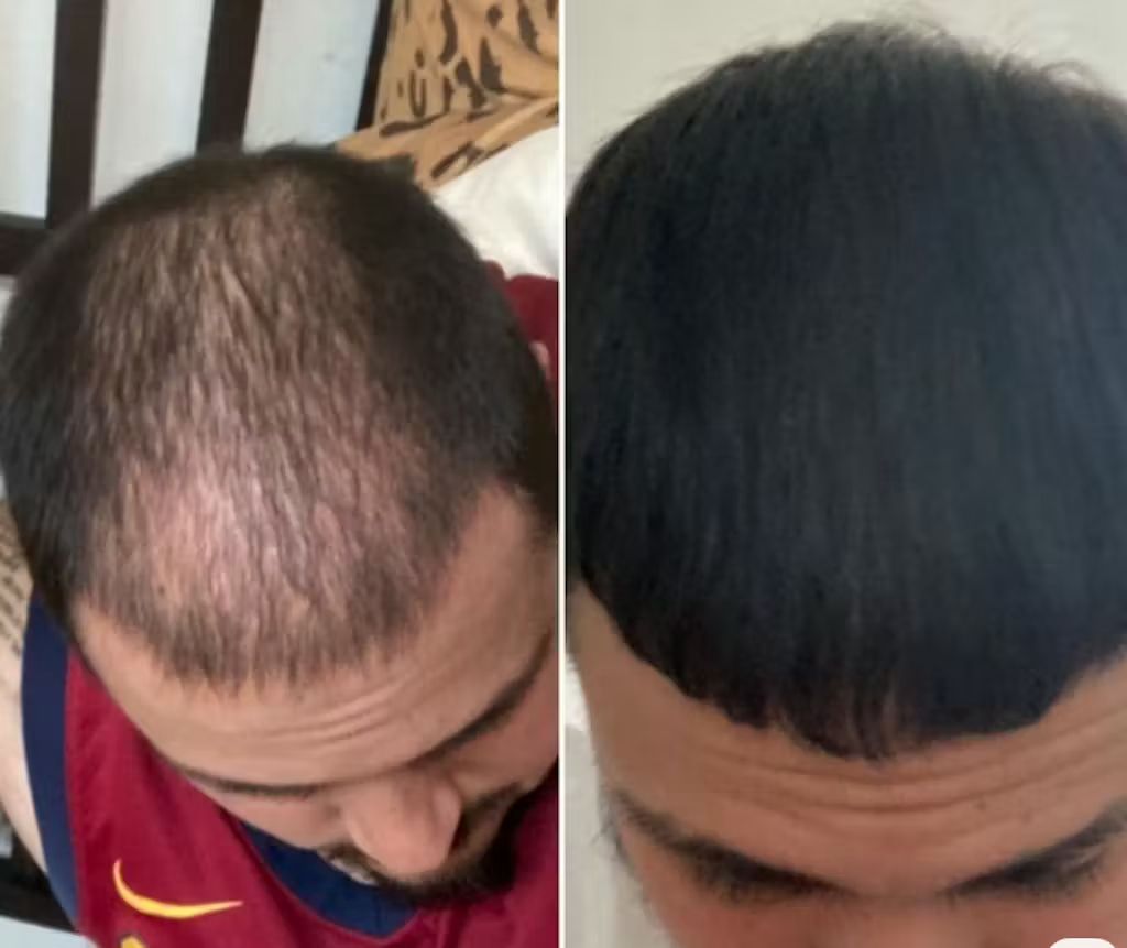 RBS Collective FollicleFX®