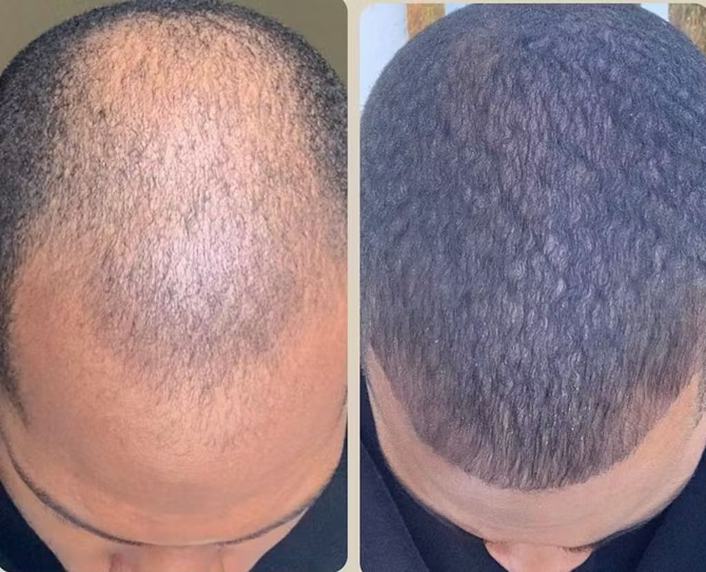 RBS Collective FollicleFX®