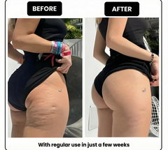 LUMORA™ RPM Mini Sculpt Roller