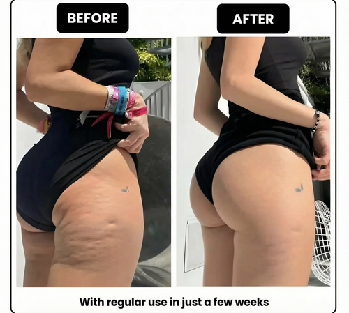 LUMORA™ RPM Mini Sculpt Roller